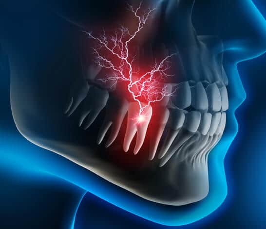 What are Dental Emergencies