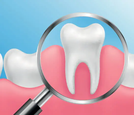 candidate for a Periodontal Scaling and Root Planing