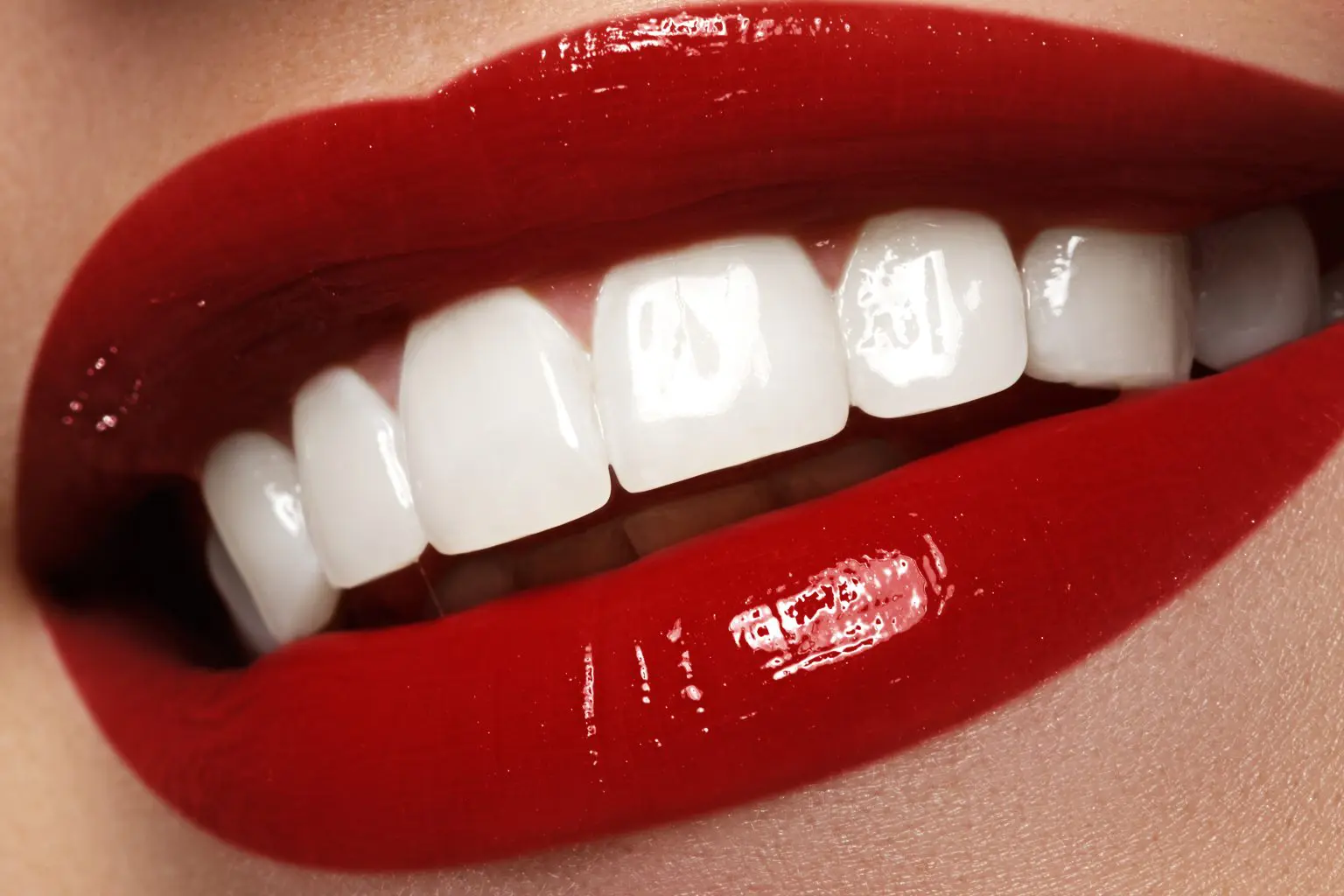 Teeth whitening in Duncanville, TX