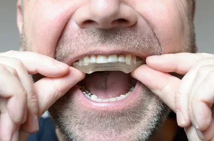 The occlusal plate, to protect the teeth